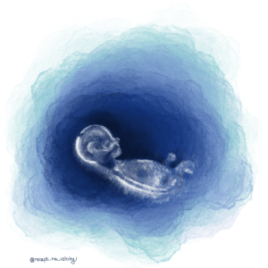 PCOS diagnoza otehotneni